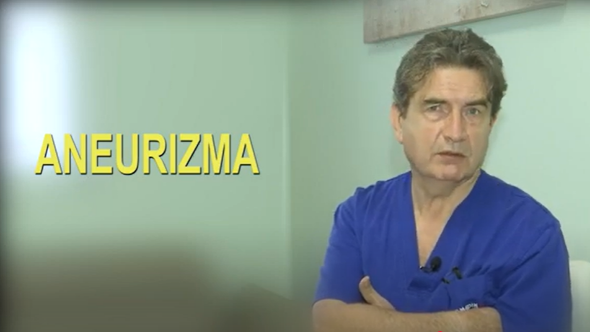 ANEURIZMA