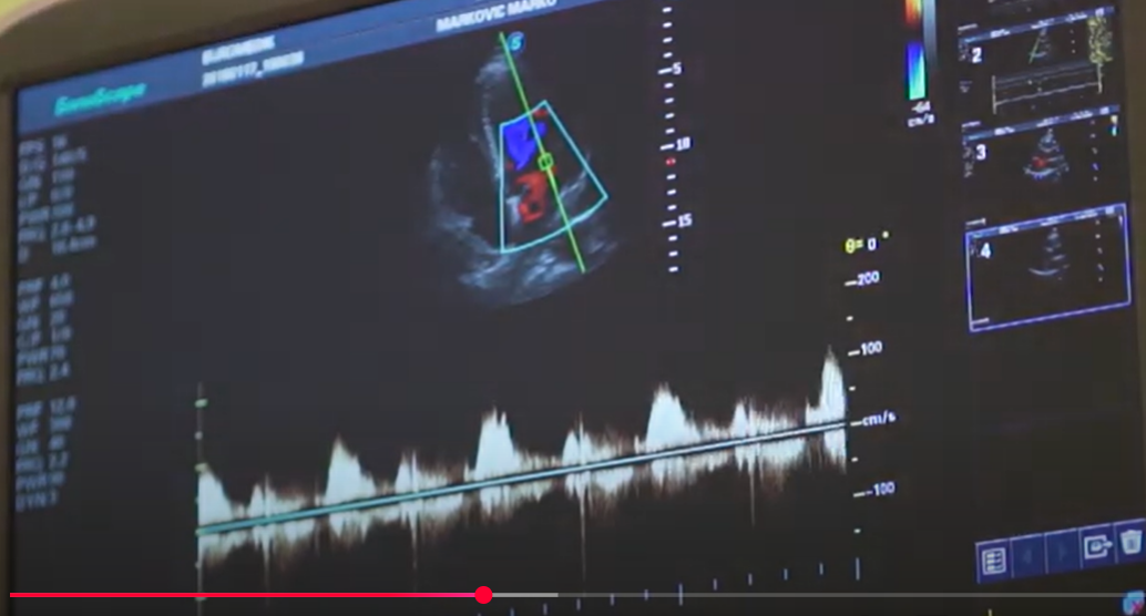 Aneurizmatska bolest