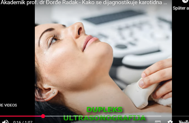 Kako se dijagnostifikuje karotidna bolest?