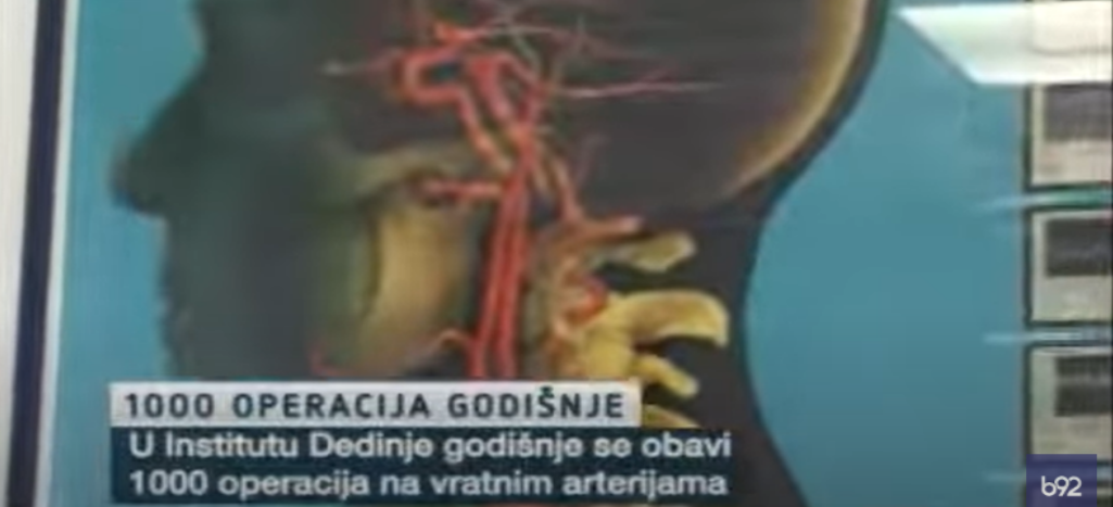 Kako sprečiti moždane udare