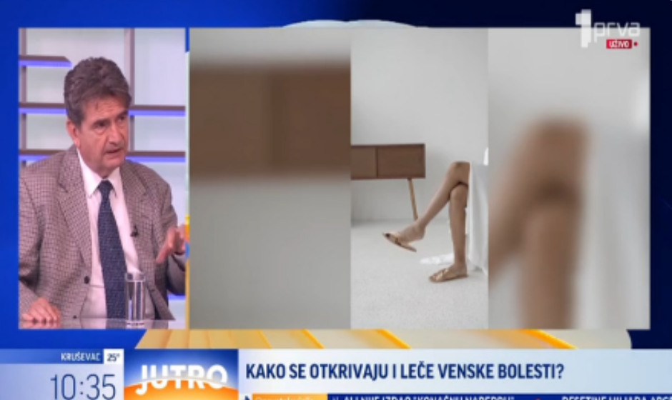 Kako nastaju venske bolesti i kako ih otkriti?