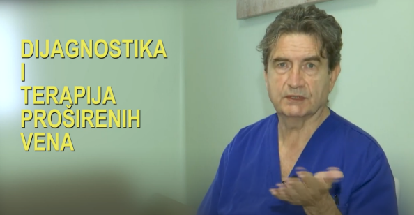 DIJAGNOSTIKA I TERAPIJA PROŠIRENIH VENA