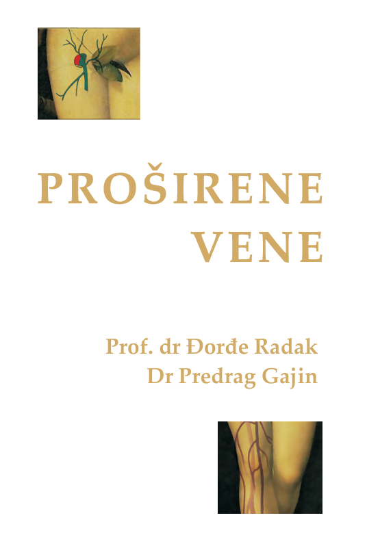 PROŠIRENE VENE